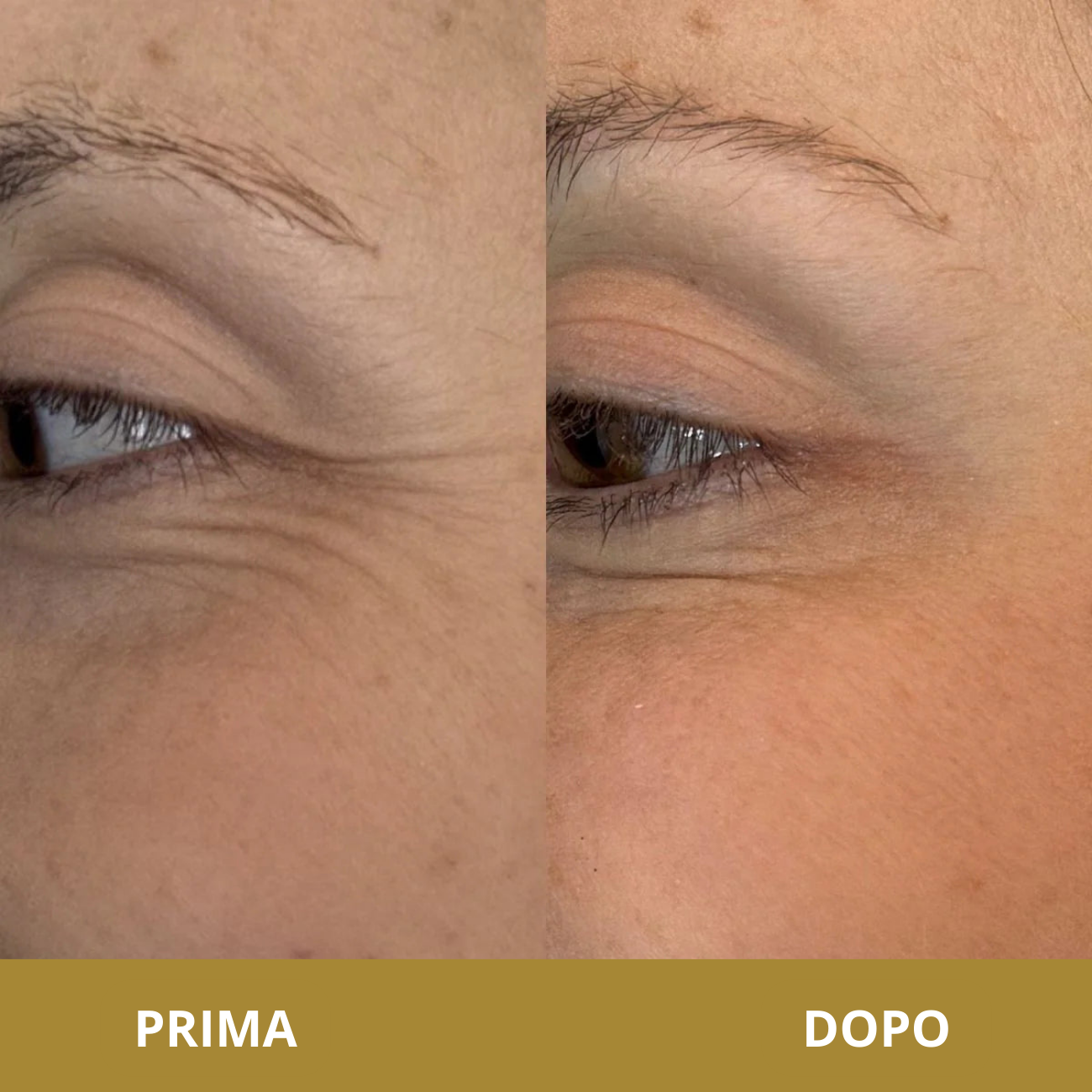 Oravia crema Anti-Età Contorno Occhi